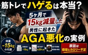 筋トレでハゲるは本当？5ヶ月で15kg減量した男性に起きたAGA悪化の実例